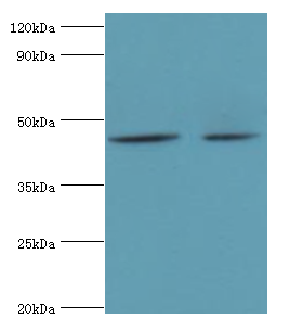 BCKDK Antibody - Western blot. All lanes: BCKDK antibody at 5 ug/ml. Lane 1: 293T whole cell lysate. Lane 2: HeLa whole cell lysate. Secondary antibody: Goat polyclonal to rabbit at 1:10000 dilution. Predicted band size: 46 kDa. Observed band size: 46 kDa.