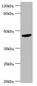 BCKDK Antibody - Western blot All lanes: BCKDK antibody at 5µg/ml + Hela whole cell lysate Secondary Goat polyclonal to rabbit IgG at 1/10000 dilution Predicted band size: 47, 38, 42 kDa Observed band size: 47 kDa
