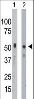 BCKDK Antibody - The anti-BCKDK antibody is used in Western blot to detect BCKDK in mouse intestine tissue lysate (Lane 1) and HeLa cell lysate (Lane 2).