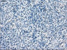 BCKDK Antibody - IHC of paraffin-embedded Human Ovary tissue using anti-BCKDK mouse monoclonal antibody.