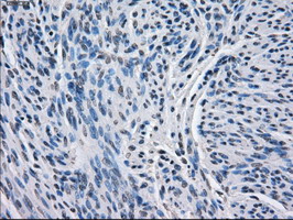 BCKDK Antibody - IHC of paraffin-embedded Human endometrium tissue using anti-BCKDK mouse monoclonal antibody.
