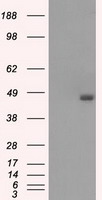 BCKDK Antibody - HEK293T cells were transfected with the pCMV6-ENTRY control (Left lane) or pCMV6-ENTRY BCKDK (Right lane) cDNA for 48 hrs and lysed. Equivalent amounts of cell lysates (5 ug per lane) were separated by SDS-PAGE and immunoblotted with anti-BCKDK.