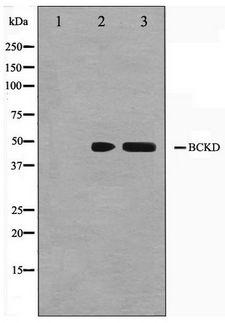 BCKDK Antibody - Western blot of Jurkat and K562 cell lysate using BCKD Antibody