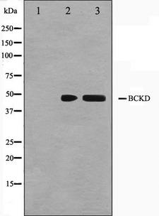BCKDK Antibody - Western blot analysis on Jurkat and K562 cell lysates using BCKD antibody. The lane on the left is treated with the antigen-specific peptide.