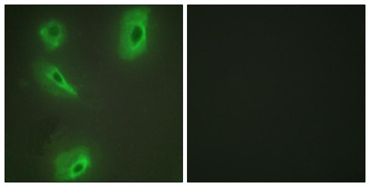 BCKDK Antibody - Peptide - + Immunofluorescence analysis of HeLa cells, using BCKD antibody.