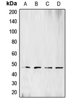 BCKDK Antibody - Western blot analysis of BCKDK expression in Raji (A); HeLa (B); Jurkat (C); SHSY5Y (D) whole cell lysates.