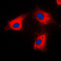 BCKDK Antibody - Immunofluorescent analysis of BCKDK staining in HeLa cells. Formalin-fixed cells were permeabilized with 0.1% Triton X-100 in TBS for 5-10 minutes and blocked with 3% BSA-PBS for 30 minutes at room temperature. Cells were probed with the primary antibody in 3% BSA-PBS and incubated overnight at 4 C in a humidified chamber. Cells were washed with PBST and incubated with a DyLight 594-conjugated secondary antibody (red) in PBS at room temperature in the dark. DAPI was used to stain the cell nuclei (blue).