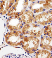 BCL10 / BCL-10 Antibody - Immunohistochemical of paraffin-embedded H. kidney section using BCL10 Antibody. Antibody was diluted at 1:25 dilution. A peroxidase-conjugated goat anti-rabbit IgG at 1:400 dilution was used as the secondary antibody, followed by DAB staining.