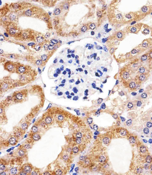 BCL10 / BCL-10 Antibody - Immunohistochemical of paraffin-embedded M. kidney section using BCL10 Antibody. Antibody was diluted at 1:25 dilution. A peroxidase-conjugated goat anti-rabbit IgG at 1:400 dilution was used as the secondary antibody, followed by DAB staining.
