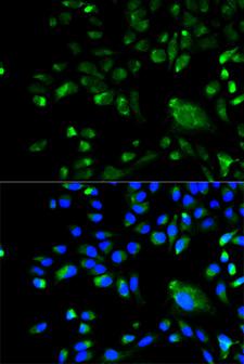 BCL10 / BCL-10 Antibody - Immunofluorescence analysis of A549 cells.