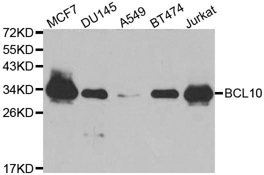 BCL10 / BCL-10 Antibody - Western blot analysis of extracts of various cell lines, using BCL10 antibody at 1:1000 dilution. The secondary antibody used was an HRP Goat Anti-Rabbit IgG (H+L) at 1:10000 dilution. Lysates were loaded 25ug per lane and 3% nonfat dry milk in TBST was used for blocking.