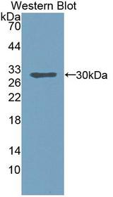 BCL10 / BCL-10 Antibody - Western blot of BCL10 / BCL-10 antibody.