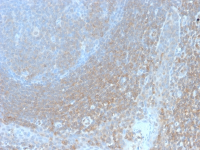 BCL10 / BCL-10 Antibody - Formalin-fixed, paraffin-embedded human Tonsil stained with BCL10 Recombinant Rabbit Monoclonal Antibody (BL10/2988R).
