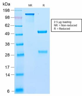 BCL10 / BCL-10 Antibody - SDS-PAGE Analysis Purified BCL10 Recombinant Rabbit Monoclonal Antibody (BL10/2988R). Confirmation of Purity and Integrity of Antibody.