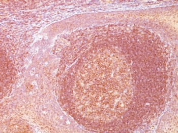 BCL10 / BCL-10 Antibody - Formalin-fixed, paraffin-embedded human tonsil stained with Bcl10 antibody (SPM520).  This image was taken for the unmodified form of this product. Other forms have not been tested.