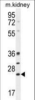 BCL10 / BCL-10 Antibody - BCL10 Antibody western blot of mouse kidney tissue lysates (35 ug/lane). The BCL10 antibody detected the BCL10 protein (arrow).