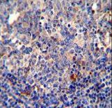 BCL10 / BCL-10 Antibody - BCL10 antibody immunohistochemistry of formalin-fixed and paraffin-embedded human tonsil tissue followed by peroxidase-conjugated secondary antibody and DAB staining.