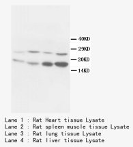 BCL10 / BCL-10 Antibody -  This image was taken for the unconjugated form of this product. Other forms have not been tested.