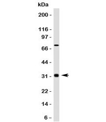 BCL10 / BCL-10 Antibody - Western blot testing of Bcl10 antibody and HepG2 lysate. Observed molecular weight: 26~33 kDa.  This image was taken for the unmodified form of this product. Other forms have not been tested.