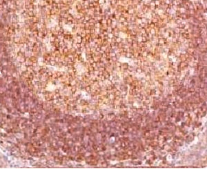 BCL10 / BCL-10 Antibody - IHC staining of human tonsil with Bcl10 antibody (MUBC10).