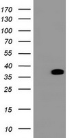 BCL10 / BCL-10 Antibody - HEK293T cells were transfected with the pCMV6-ENTRY control (Left lane) or pCMV6-ENTRY BCL10 (Right lane) cDNA for 48 hrs and lysed. Equivalent amounts of cell lysates (5 ug per lane) were separated by SDS-PAGE and immunoblotted with anti-BCL10.