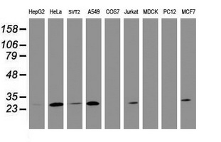 BCL10 / BCL-10 Antibody - Western blot of extracts (35 ug) from 9 different cell lines by using anti-BCL10 monoclonal antibody (HepG2: human; HeLa: human; SVT2: mouse; A549: human; COS7: monkey; Jurkat: human; MDCK: canine; PC12: rat; MCF7: human).