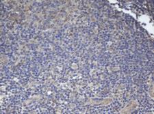 BCL10 / BCL-10 Antibody - IHC of paraffin-embedded Human lymph node tissue using anti-BCL10 mouse monoclonal antibody.