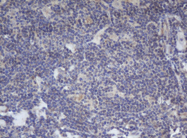 BCL10 / BCL-10 Antibody - IHC of paraffin-embedded Human lymphoma tissue using anti-BCL10 mouse monoclonal antibody.