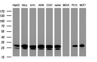 BCL10 / BCL-10 Antibody - Western blot of extracts (35 ug) from 9 different cell lines by using g anti-BCL10 monoclonal antibody (HepG2: human; HeLa: human; SVT2: mouse; A549: human; COS7: monkey; Jurkat: human; MDCK: canine; PC12: rat; MCF7: human).