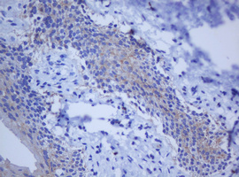 BCL10 / BCL-10 Antibody - IHC of paraffin-embedded Human bladder tissue using anti-BCL10 mouse monoclonal antibody.