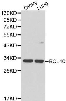 BCL10 / BCL-10 Antibody - Western blot of BCL10 pAb in extracts from mouse ovary and lung tissues.