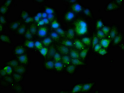 BCL10 / BCL-10 Antibody - Immunofluorescence staining of Hela cells with BCL10 Antibody at 1:133, counter-stained with DAPI. The cells were fixed in 4% formaldehyde, permeabilized using 0.2% Triton X-100 and blocked in 10% normal Goat Serum. The cells were then incubated with the antibody overnight at 4°C. The secondary antibody was Alexa Fluor 488-congugated AffiniPure Goat Anti-Rabbit IgG(H+L).