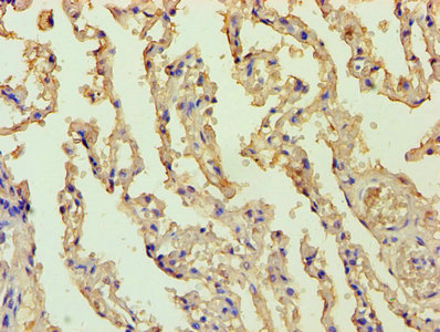 BCL10 / BCL-10 Antibody - Immunohistochemistry of paraffin-embedded human lung tissue using BCL10 Antibody at dilution of 1:100