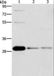 BCL10 / BCL-10 Antibody - Western blot analysis of HepG2, Raji and 293T cell, using BCL10 Polyclonal Antibody at dilution of 1:950.