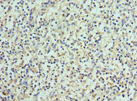 BCL11A Antibody - Immunohistochemistry of paraffin-embedded human spleen using antibody at 1:100 dilution.