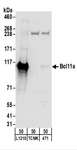 BCL11A Antibody - Detection of Mouse Bcl11a by Western Blot. Samples: Whole cell lysate (50 ug) from L1210, TCMK-1, and 4T1 cells. Antibodies: Affinity purified rabbit anti-Bcl11a antibody used for WB at 1 ug/ml. Detection: Chemiluminescence with an exposure time of 30 seconds.