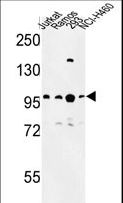 BCL11A Antibody - Western blot of BCL11A Antibody in Jurkat, Ramos, 293, NCI-H460 cell line lysates (35 ug/lane). BCL11A (arrow) was detected using the purified antibody.
