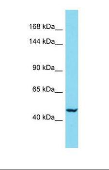 BCL11A Antibody - Western blot of Human Stomach Tumor. BCL11A antibody dilution 1.0 ug/ml.  This image was taken for the unconjugated form of this product. Other forms have not been tested.
