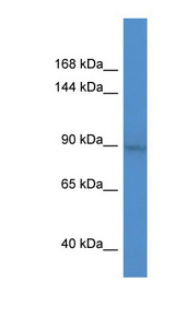 BCL11A Antibody - BCL11A antibody Western blot of PANC1 cell lysate. This image was taken for the unconjugated form of this product. Other forms have not been tested.