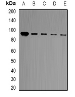 BCL11A Antibody - Western blot analysis of BCL11A expression in HT29 (A); Jurkat (B); HeLa (C); A549 (D); mouse brain (E) whole cell lysates.