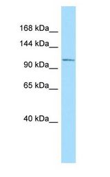 BCL11A Antibody - BCL11A antibody Western Blot of Rat Spleen. Antibody dilution: 1 ug/ml.  This image was taken for the unconjugated form of this product. Other forms have not been tested.