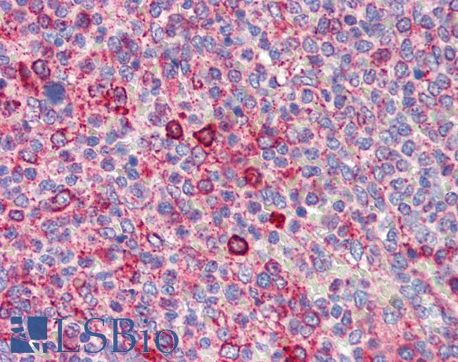 BCL11A Antibody - Anti-BCL11A antibody IHC of human spleen. Immunohistochemistry of formalin-fixed, paraffin-embedded tissue after heat-induced antigen retrieval. Antibody concentration 5 ug/ml.  This image was taken for the unconjugated form of this product. Other forms have not been tested.