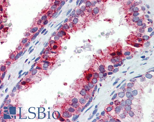 BCL11A Antibody - Anti-BCL11A antibody IHC of human prostate. Immunohistochemistry of formalin-fixed, paraffin-embedded tissue after heat-induced antigen retrieval. Antibody concentration 5 ug/ml.  This image was taken for the unconjugated form of this product. Other forms have not been tested.