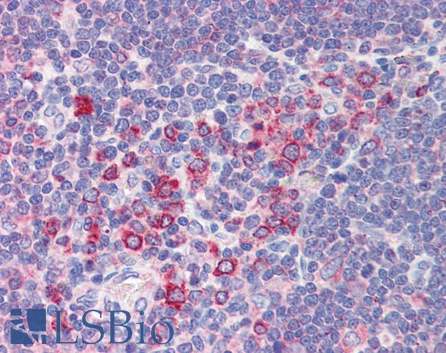BCL11A Antibody - Anti-BCL11A antibody IHC of human thymus. Immunohistochemistry of formalin-fixed, paraffin-embedded tissue after heat-induced antigen retrieval. Antibody concentration 5 ug/ml.  This image was taken for the unconjugated form of this product. Other forms have not been tested.