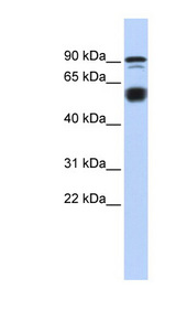 BCL11A Antibody - BCL11A antibody Western blot of Fetal Heart lysate. This image was taken for the unconjugated form of this product. Other forms have not been tested.
