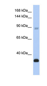 BCL11B Antibody - BCL11B antibody Western blot of THP-1 cell lysate. This image was taken for the unconjugated form of this product. Other forms have not been tested.