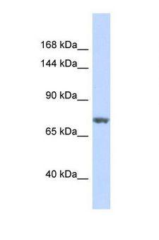 BCL11B Antibody - Western blot of Human 293T. BCL11B antibody dilution 1.0 ug/ml.  This image was taken for the unconjugated form of this product. Other forms have not been tested.