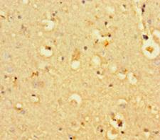 BCL11B Antibody - Immunohistochemistry of paraffin-embedded human brain tissue at dilution of 1:100
