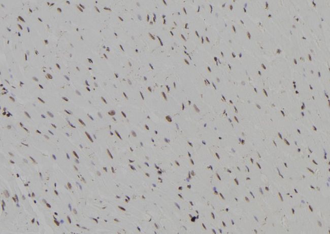 BCL11B Antibody - 1:100 staining rat heart tissue by IHC-P. The sample was formaldehyde fixed and a heat mediated antigen retrieval step in citrate buffer was performed. The sample was then blocked and incubated with the antibody for 1.5 hours at 22°C. An HRP conjugated goat anti-rabbit antibody was used as the secondary.