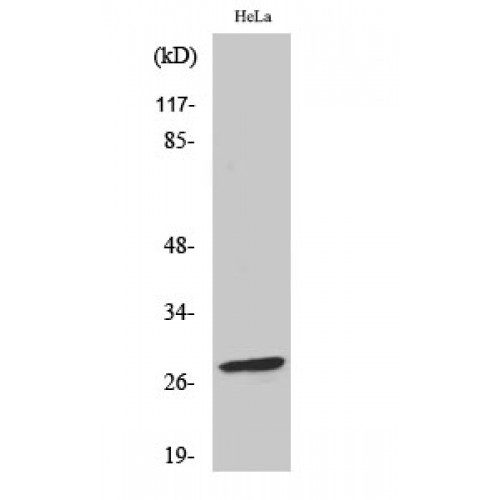 BCL2 / Bcl-2 Antibody - Western blot of Phospho-Bcl-2 (S70) antibody